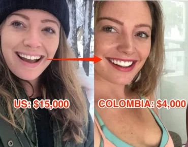 Cost comparisons United States vs Colombia